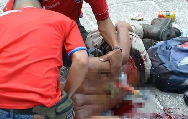 Dopo il sogno per la Costa Rica, svanito solamente ai calci di rigore con l'Olanda, ecco la violenza. E il sangue. Gravi incidenti dopo l’eliminazione dei Ticos.