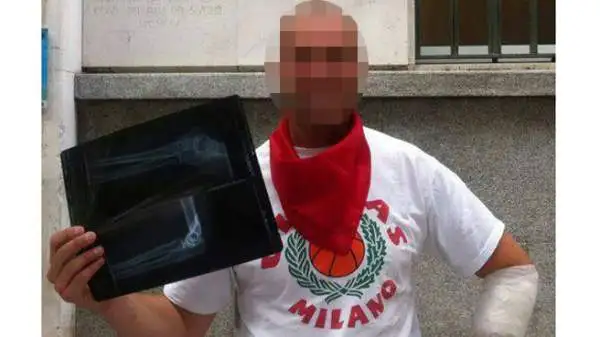 Ivan Luraschi, leader degli 'Ultras Milano', se l'è vista brutta a Pamplona, in occasione dell'encierro.
