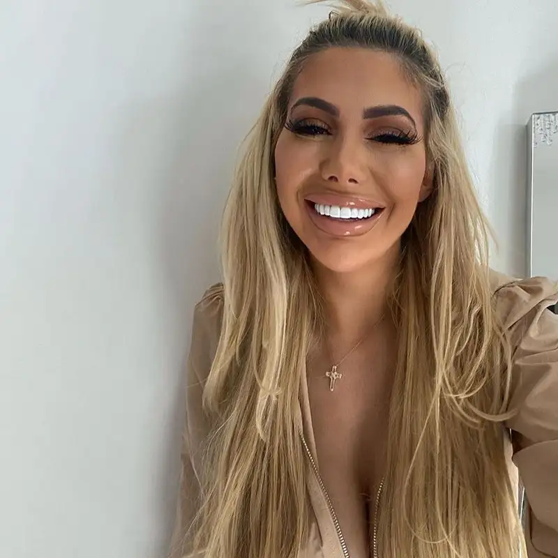Chloe Ferry, stellina della tv inglese, ha un patrimonio netto superiore al milione di sterline.