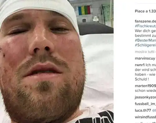 Grosskreutz licenziato per una rissa: si ritira