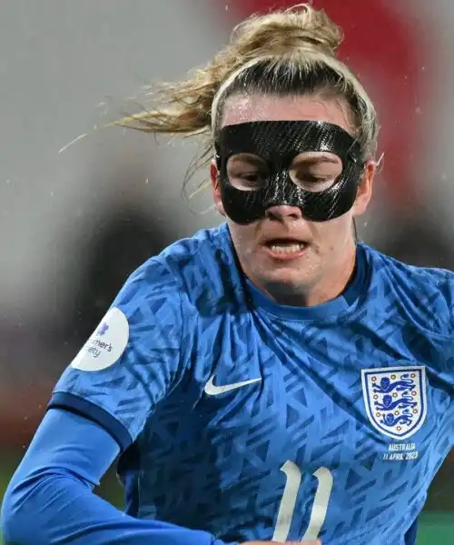 La donna in maschera non ferma le ‘Matildas’: le foto della prestigiosa vittoria