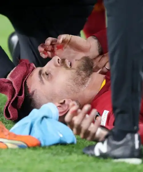 Lorenzo Pellegrini ferito alla testa: non gioca la prossima partita. Foto