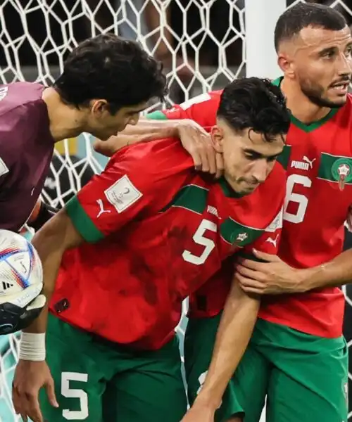 Marocco-Spagna, problemi per Nayef Aguerd: le foto