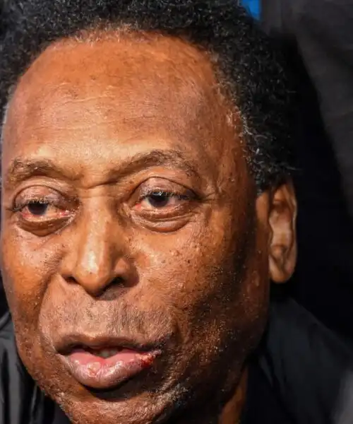 Pelé, messaggio dall’ospedale: “Restate calmi, sono forte”