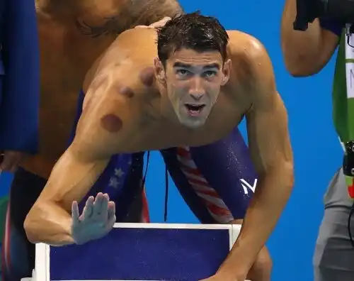 Quei cerchi rossi sul corpo di Phelps…
