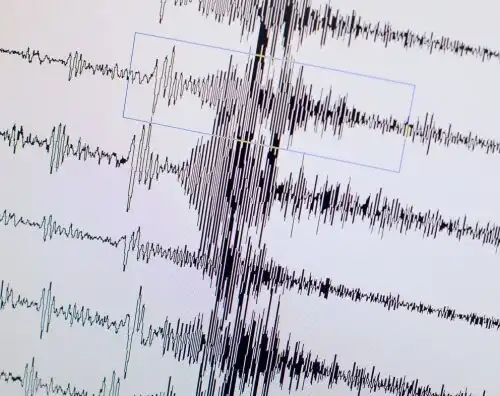 Terremoto in Centro Italia, diverse vittime