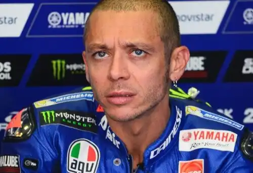 Valentino Rossi: tibia e perone rotti?