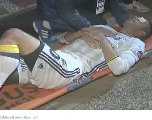 Van Persie ha rischiato di perdere l’occhio