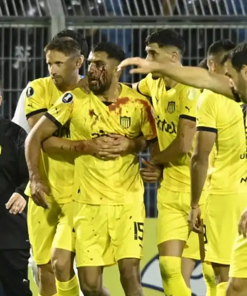 Vergogna allo stadio: giocatore colpito da una pietra. Foto