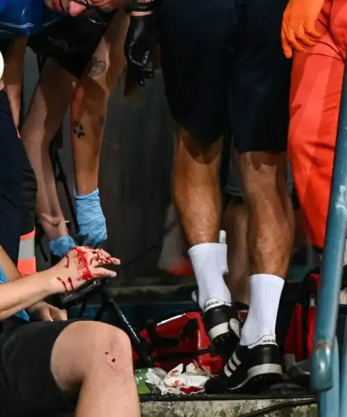 Incidente allo stadio: fotografo ferito alla testa da un pannello di vetro. Le foto