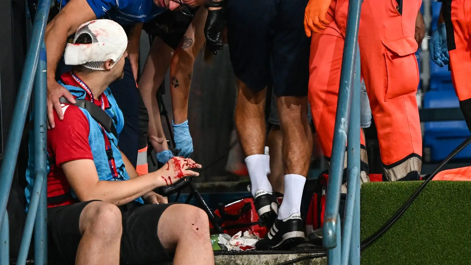 Fotografo colpito da un pannello di vetro: spavento enorme. Le foto dell'incidente
