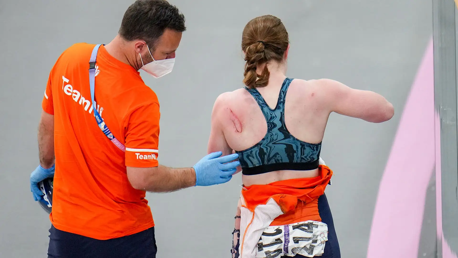 La ciclista ha riportato una ferita alla spalla ma nulla di grave
