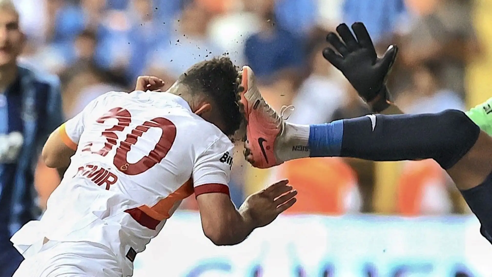 Il calciatore ha ricevuto un calcio in testa
