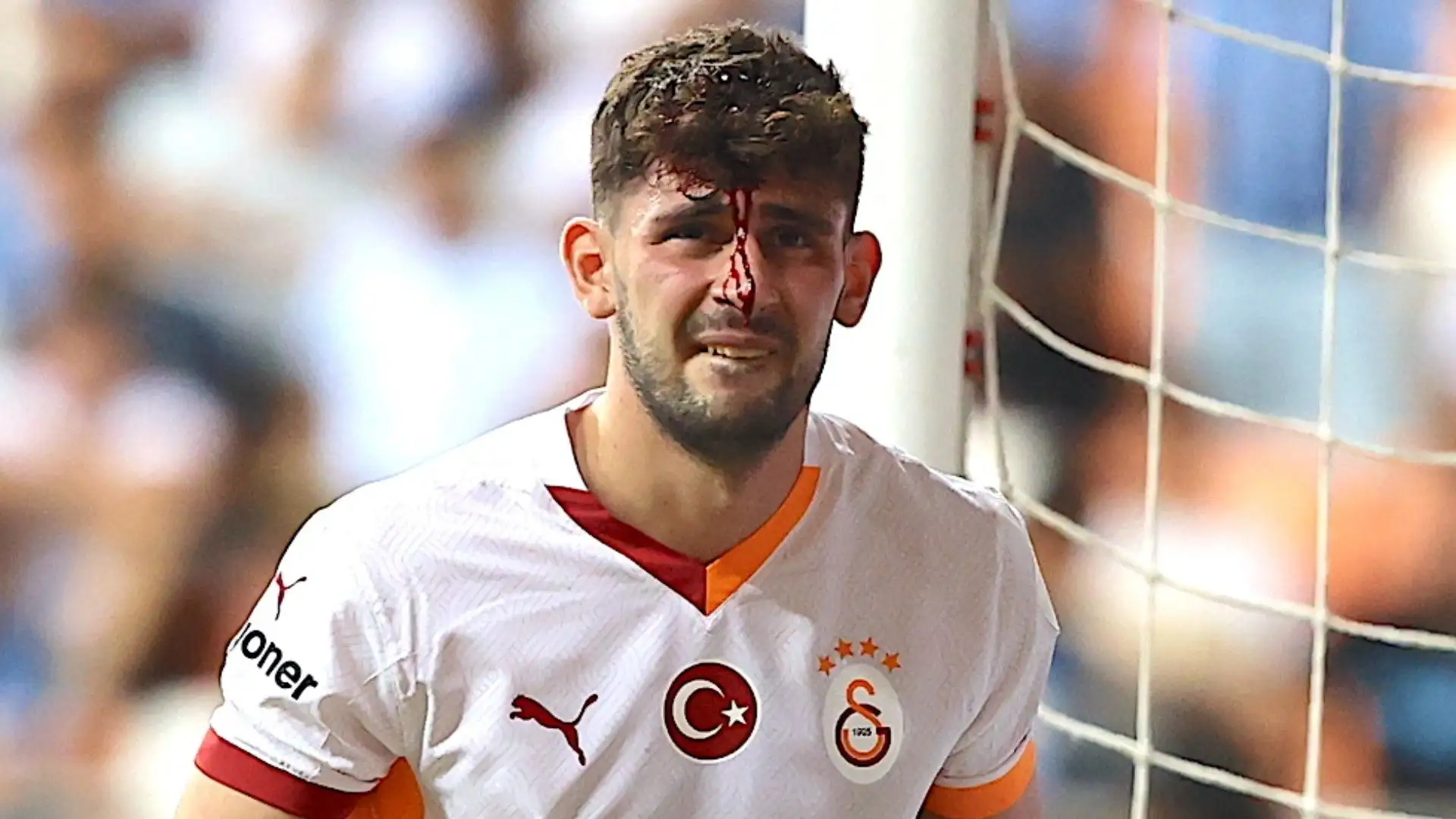 Il campione perdeva sangue dalla testa
