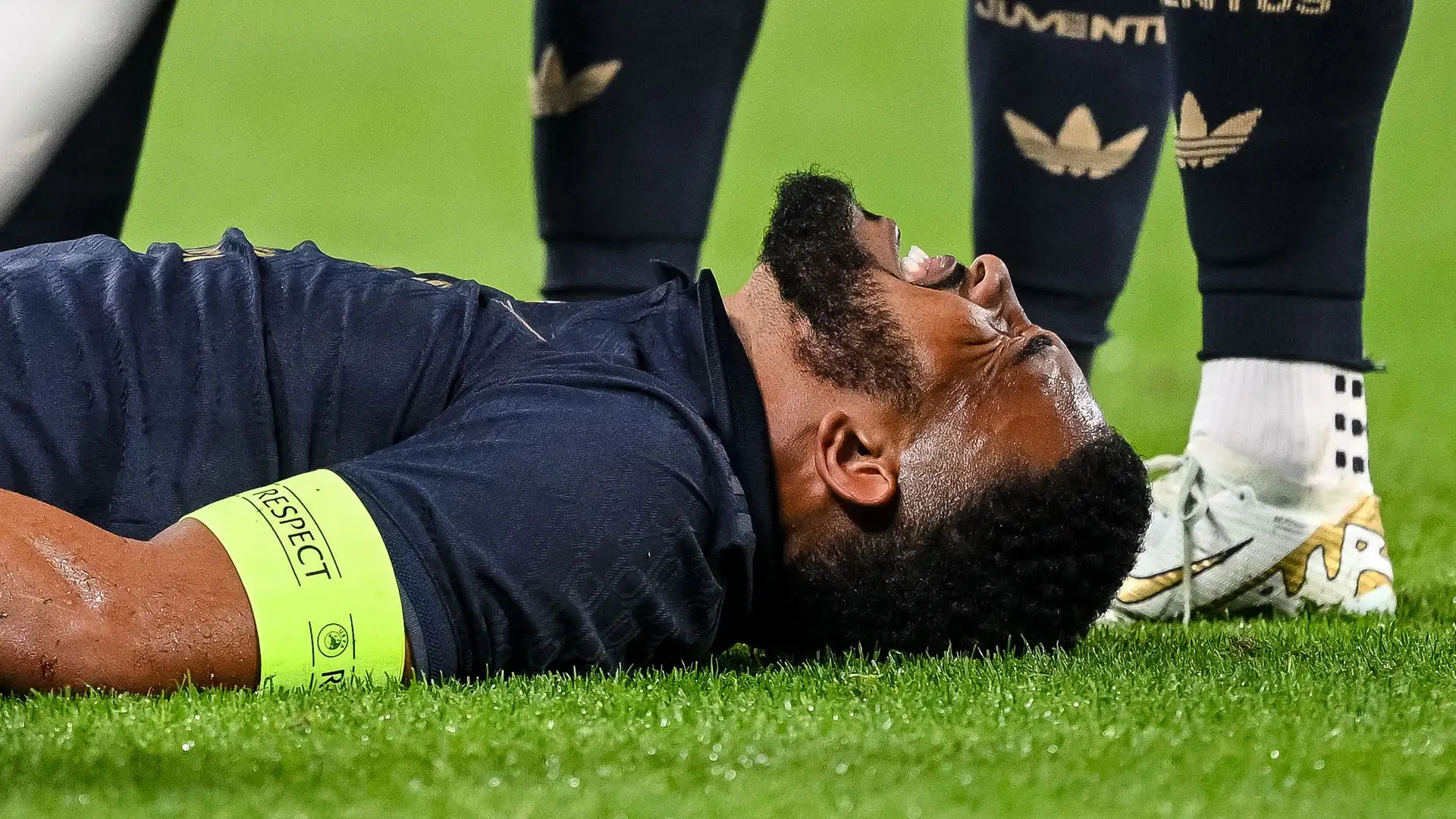 Anche Bremer della Juventus si è fatto male: dovrà stare lontano dal campo diversi mesi
