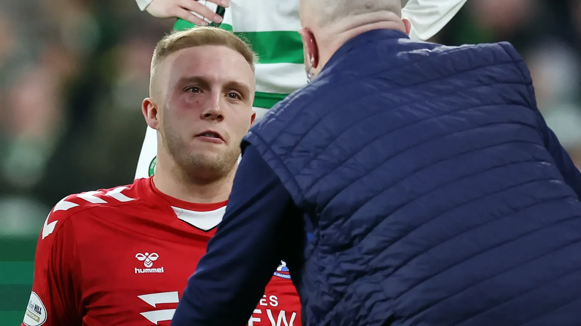 Il portiere ha ricevuto una violenta ginocchiata in faccia
