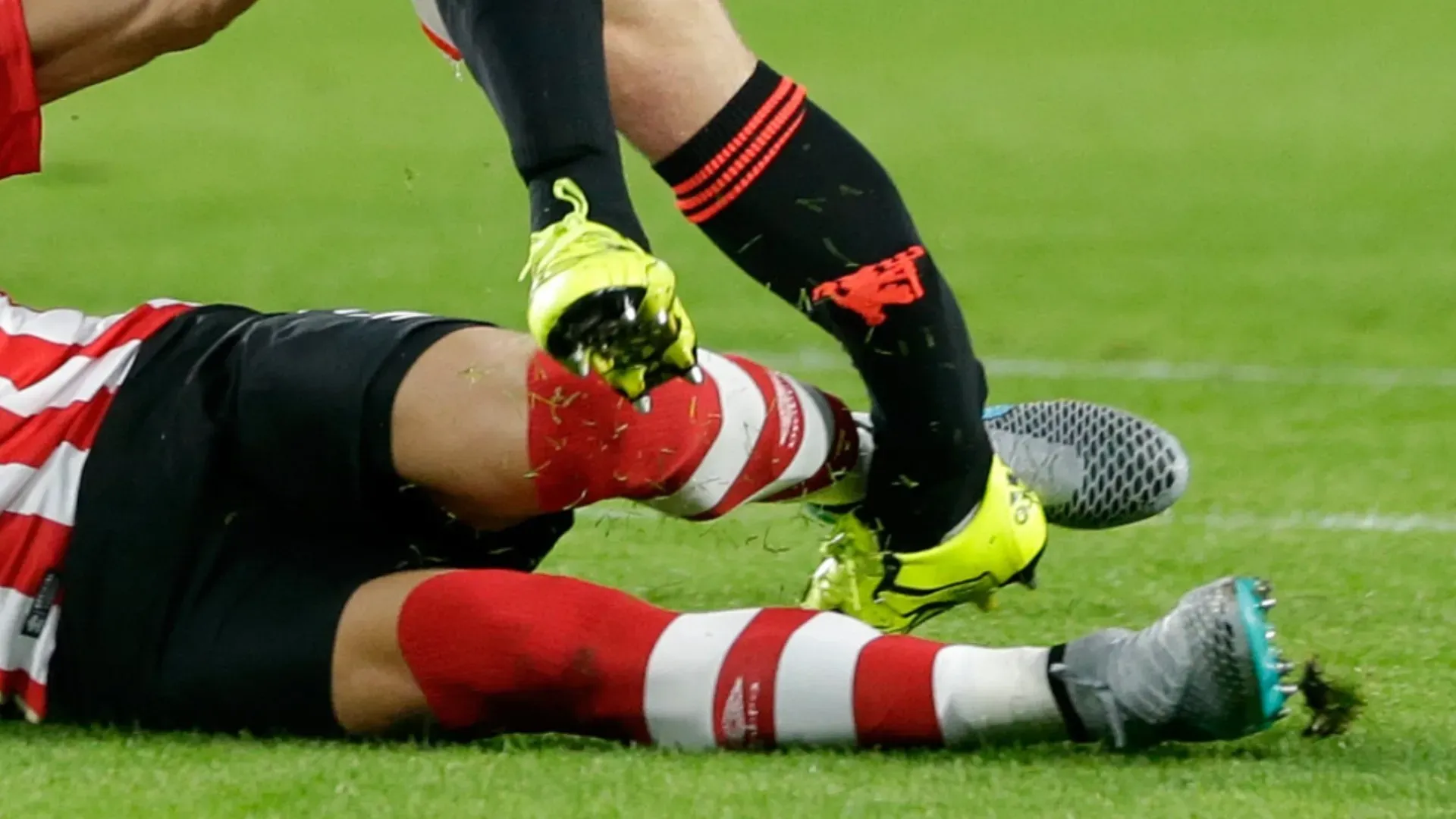 Quasi cinque anni di infortuni: Luke Shaw e un destino sfortunato
