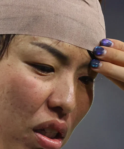 Il sangue non la ferma: le foto dell’eroica Saki Kumagai