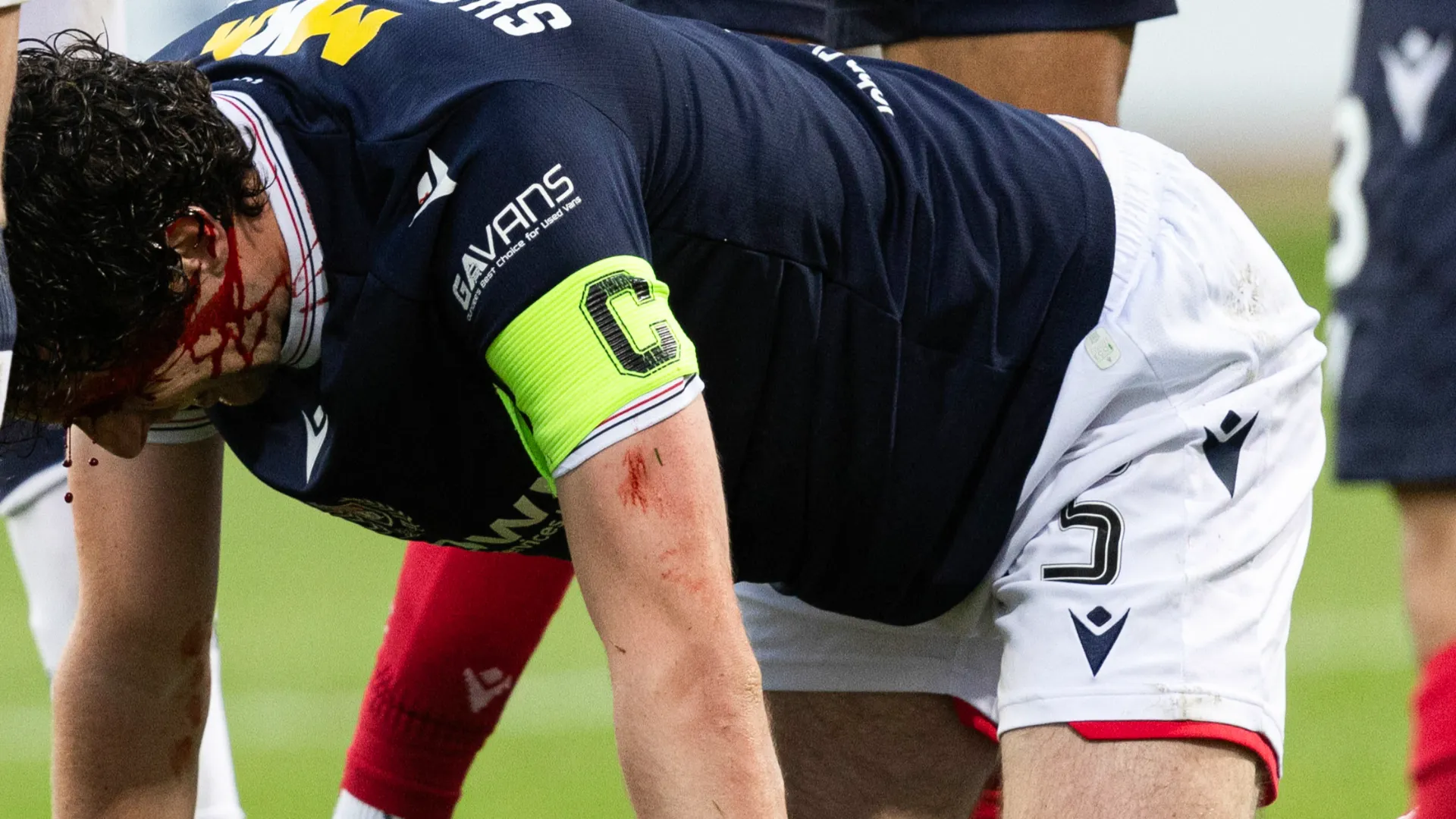 Il capitano del Dundee ha perso molto sangue
