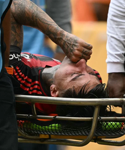 Autogol e grave infortunio: serata da incubo per il giocatore. Le foto