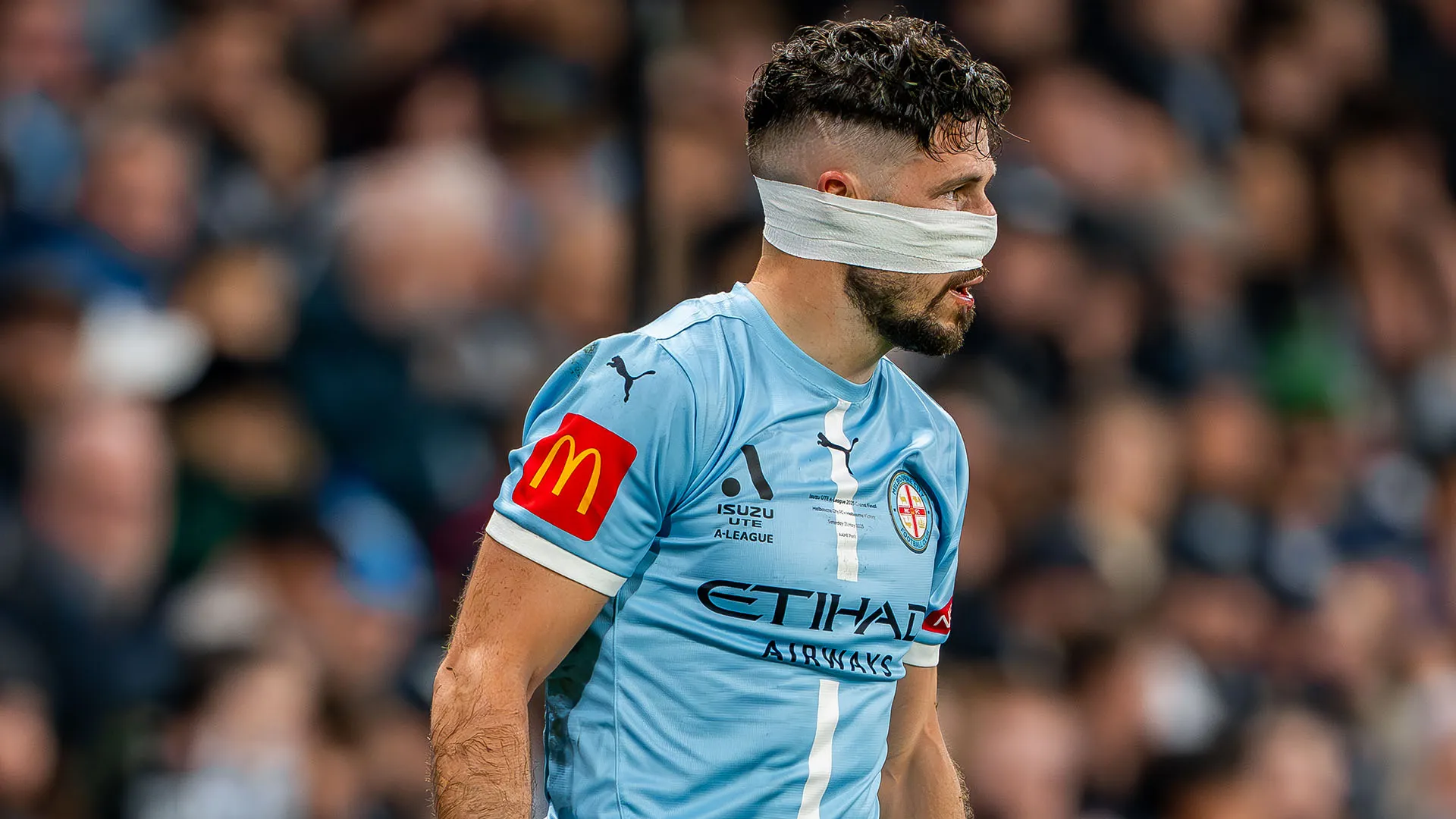 Durante il match Leckie si è infortunato al naso
