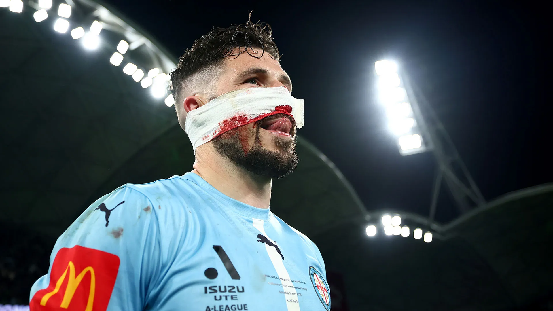 A Mathew Leckie è stato applicato un ingombrante bendaggio al naso
