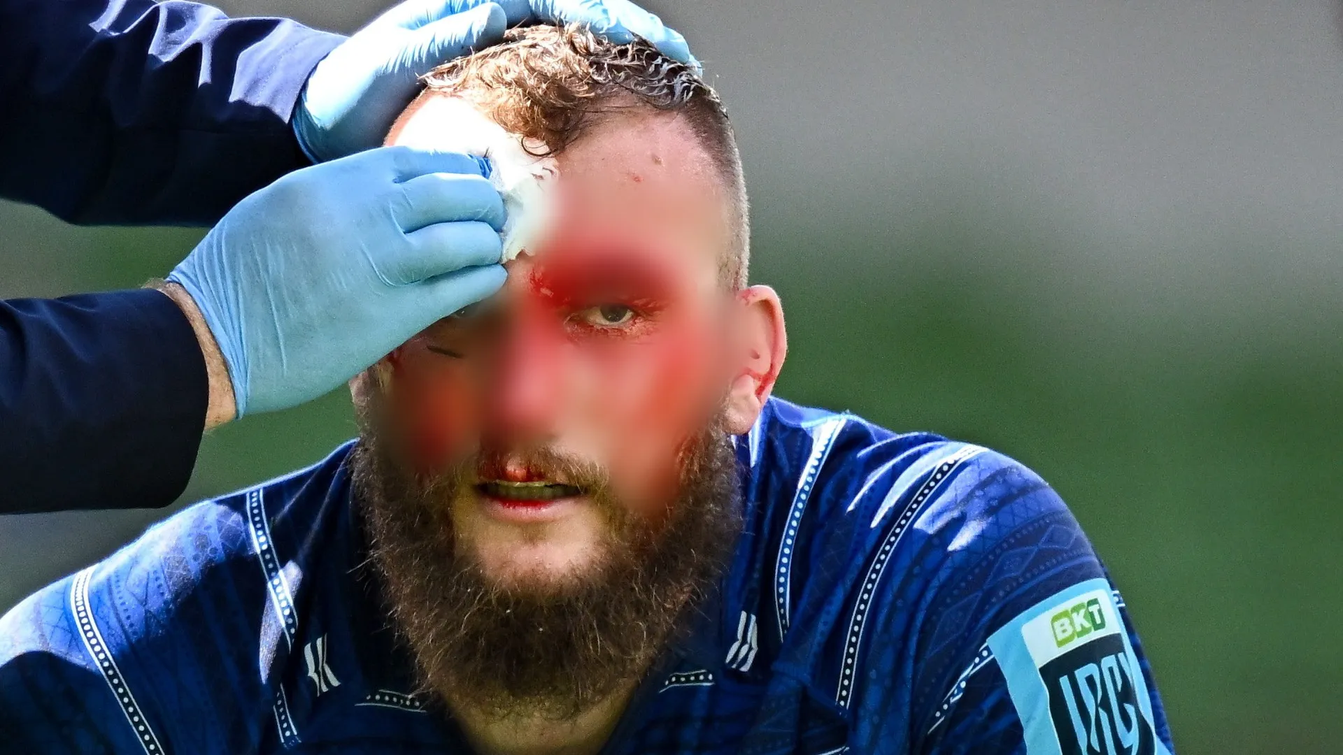 Il campione si è fatto male durante Leinster-Scarlets
