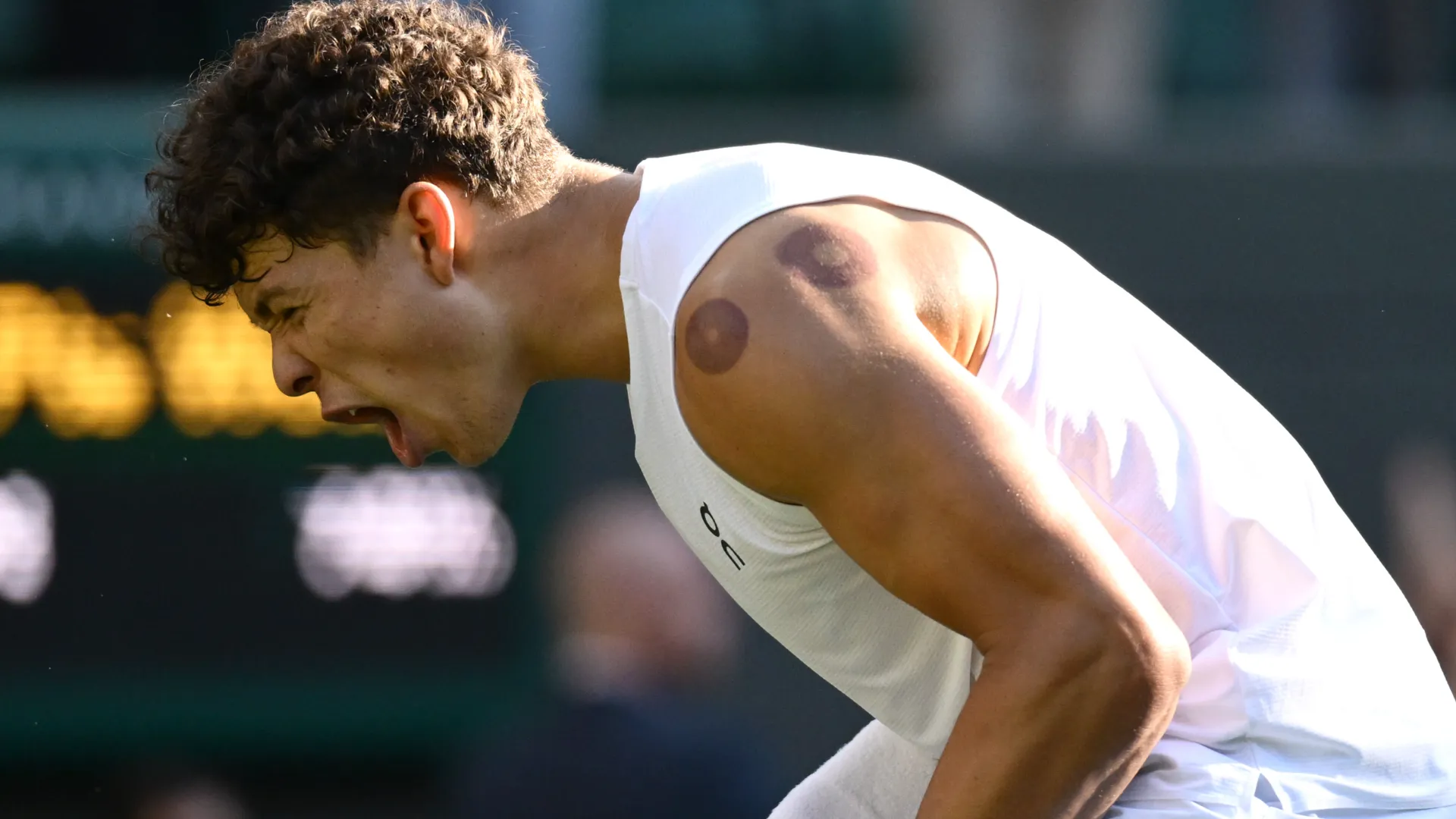 Durante il match contro Lorenzo Sonego, il tennista statunitense ha mostrato alcuni segni sulle spalle
