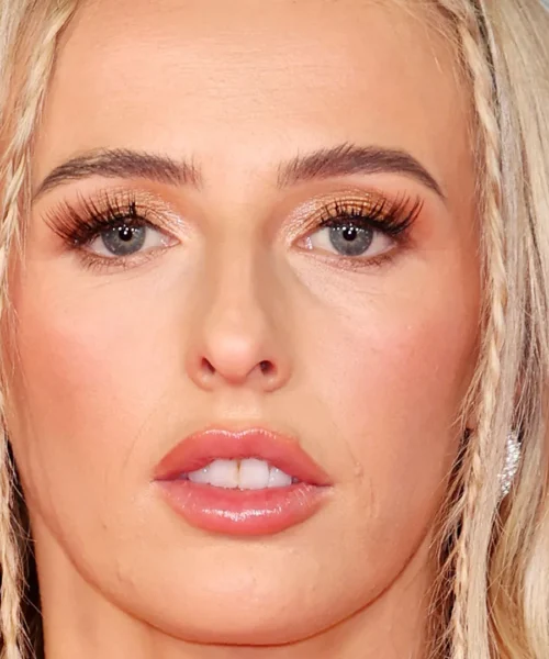 Campionessa con la passione del red carpet, le più belle foto di Chloe Kelly