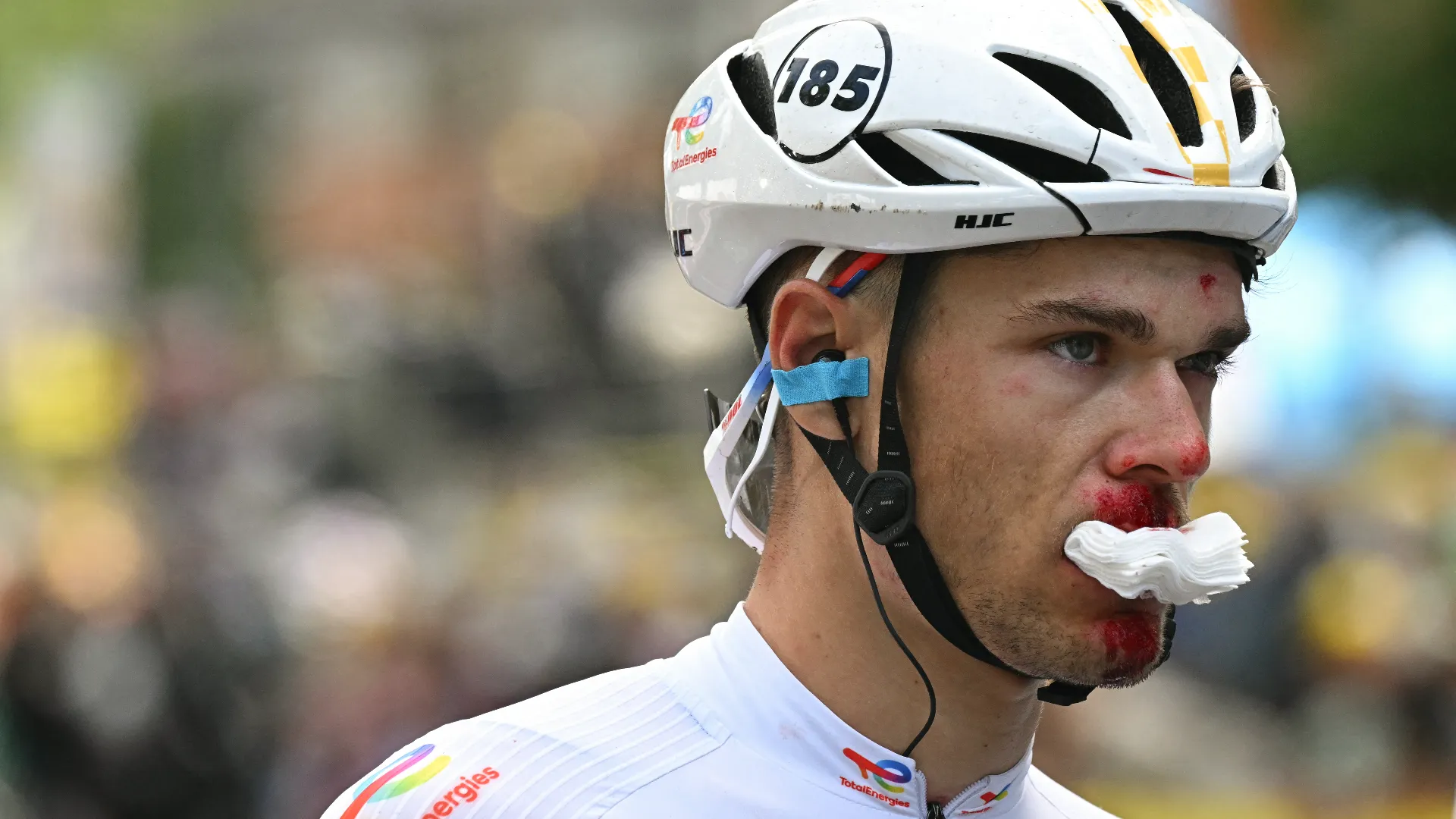 Ha sbattuto violentemente la faccia contro il metallo e ha perso sangue
