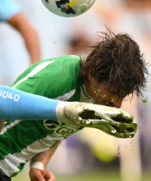 Violento calcio in testa: ha rischiato tantissimo. Le foto