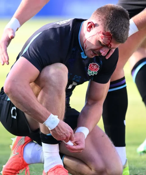 Continua a lottare con un taglio in testa: le foto del campione