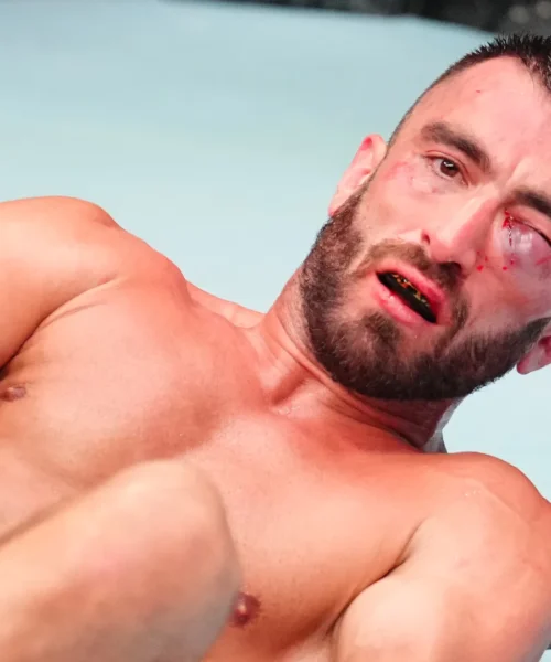 Occhio distrutto, tremendo infortunio in UFC: le foto