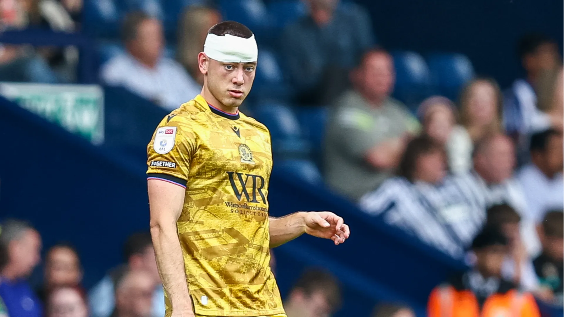 Il calciatore del Blackburn ha rimediato una ferita sopra il sopracciglio
