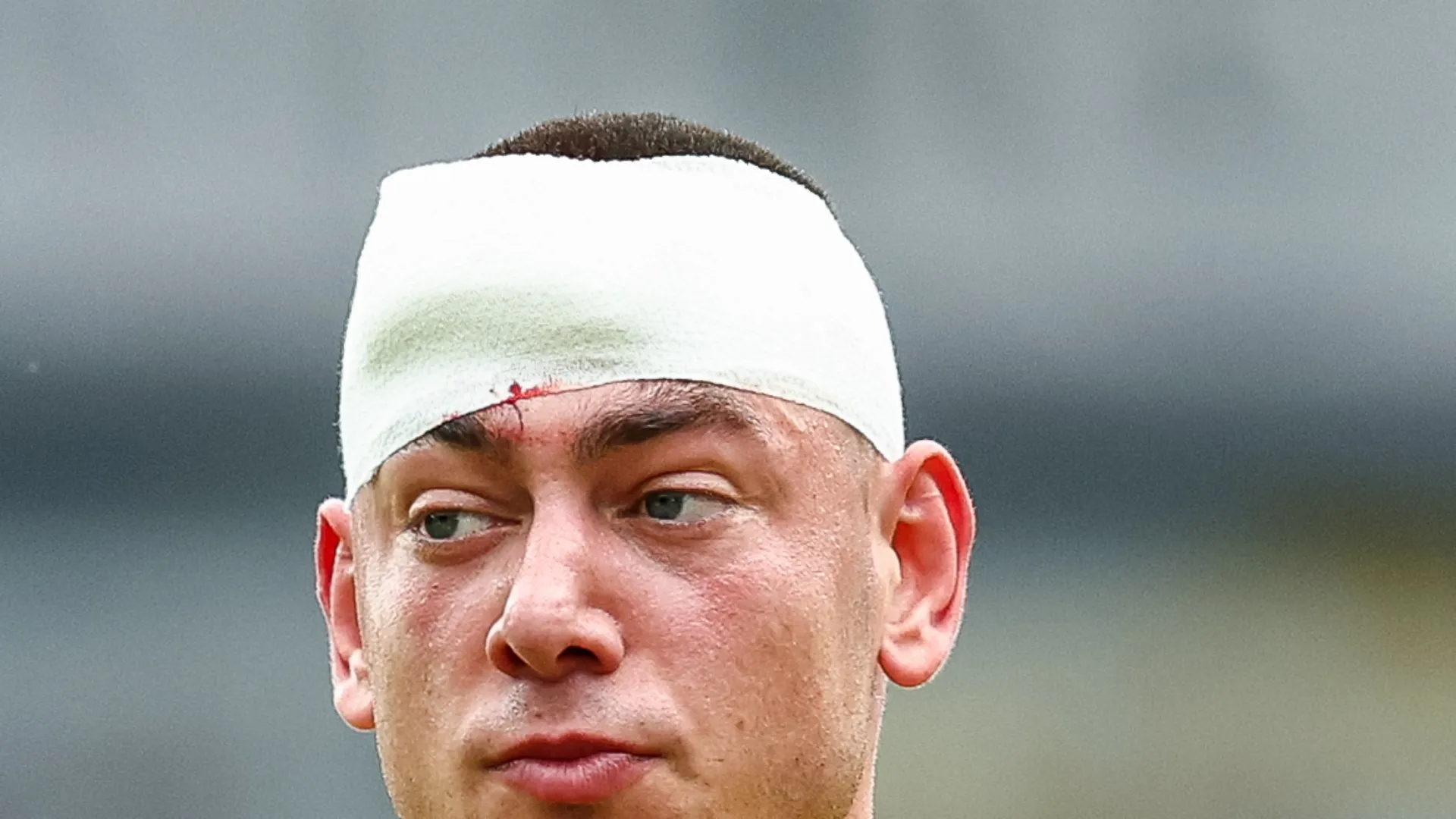 La ferita è stata tamponata e il calciatore ha potuto continuare la partita