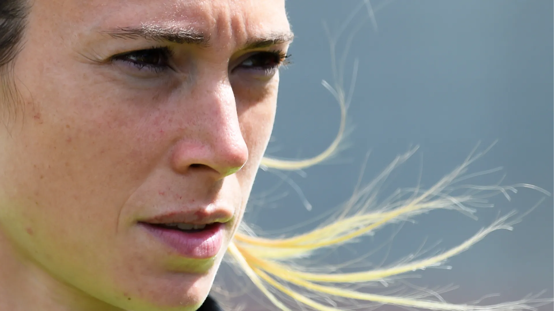 Regina Baresi operata al cuore: le foto dell’ex calciatrice