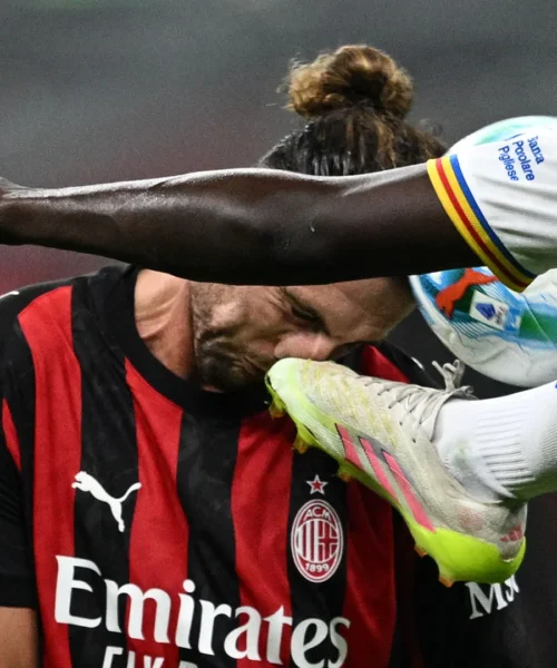 Calcio in faccia ad Adrien Rabiot: le foto del dolorosissimo colpo