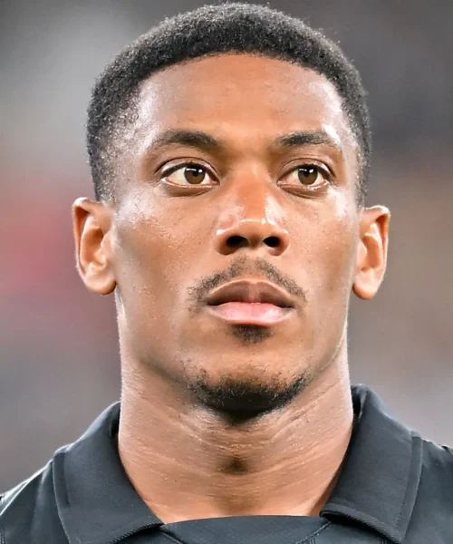 Anthony Martial travolto dalle critiche in Messico: le foto