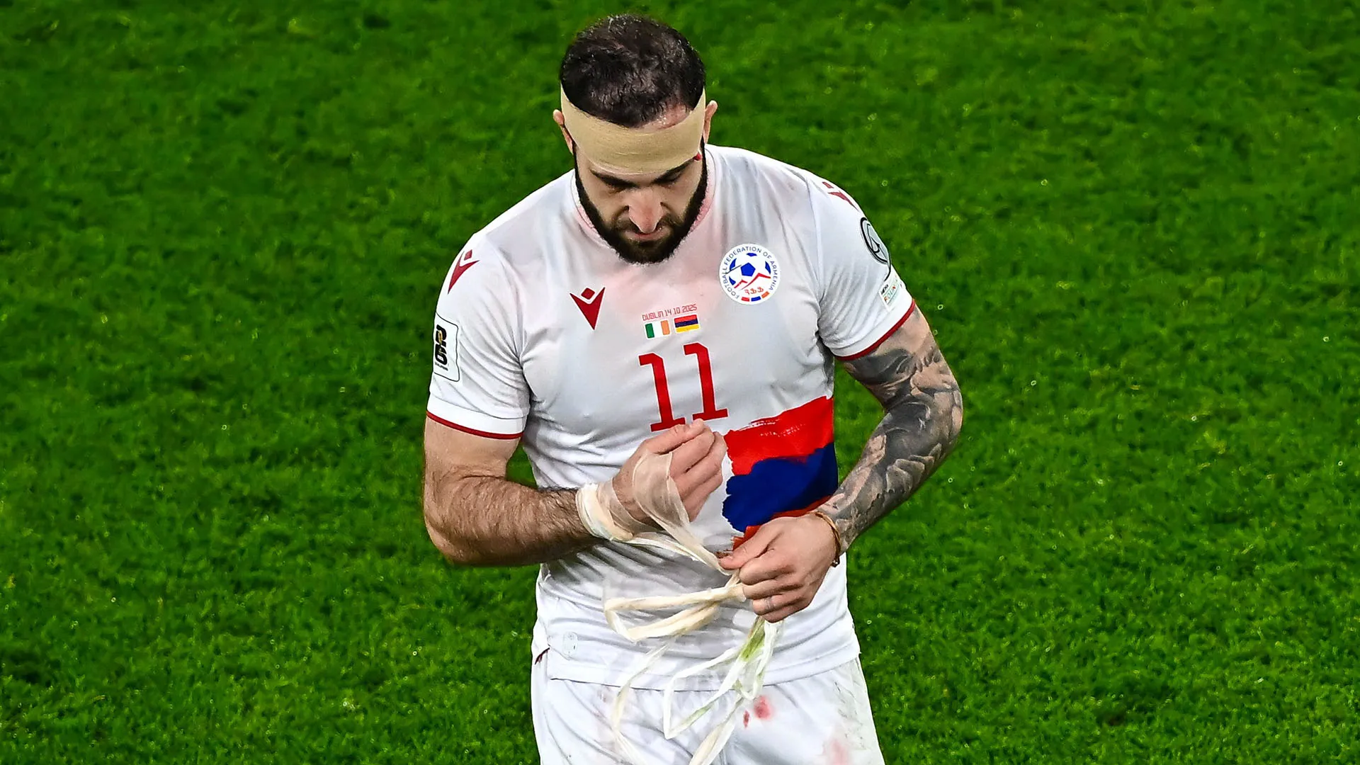 Ecco il capitano dell'Armenia mentre abbandona il campo con la maglia insanguinata