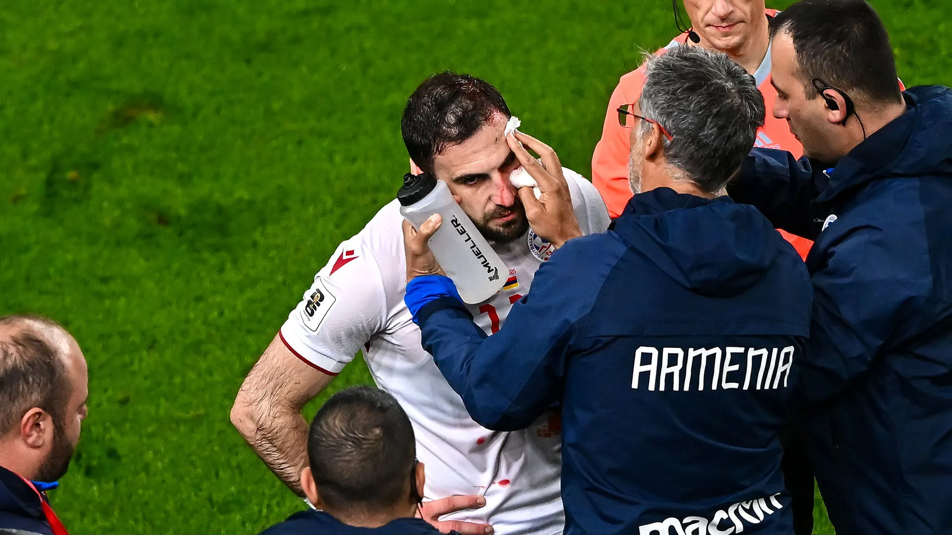 Il capitano dell'Armenia si è fatto male durante la sfida contro l'Irlanda