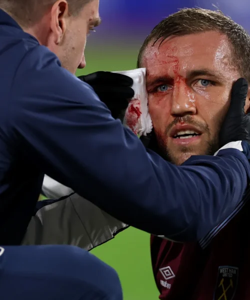 Maschera di sangue dopo lo scontro con l’avversario: le immagini