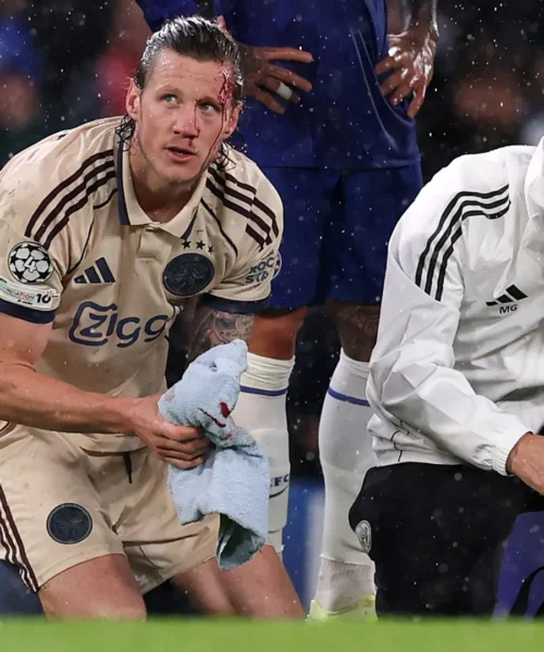 Perde sangue dalla testa: attimi di terrore per Wout Weghorst. Foto
