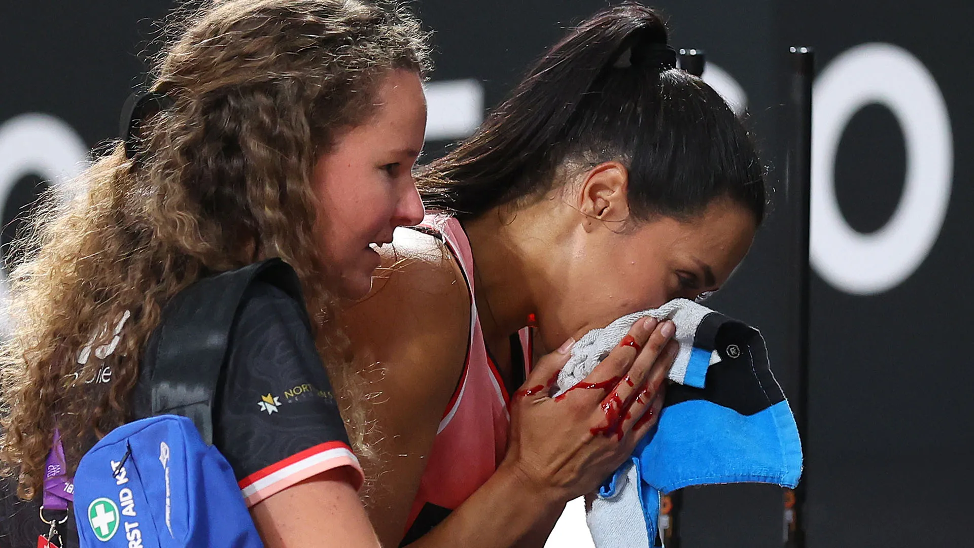 Gli esami hanno evidenziato la rottura del naso