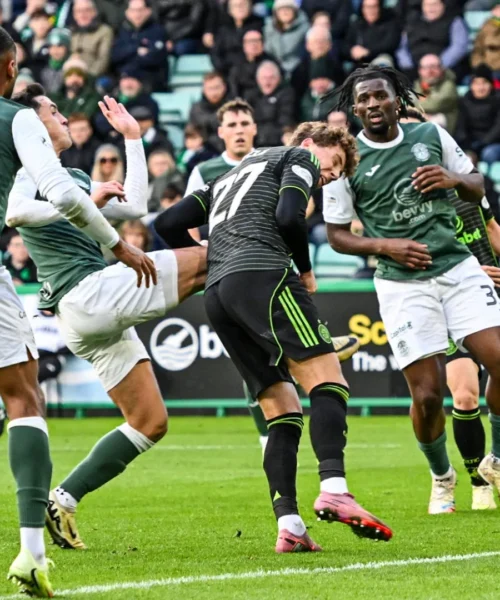 Per segnare si prende una scarpata in faccia: le foto del dolorosissimo colpo