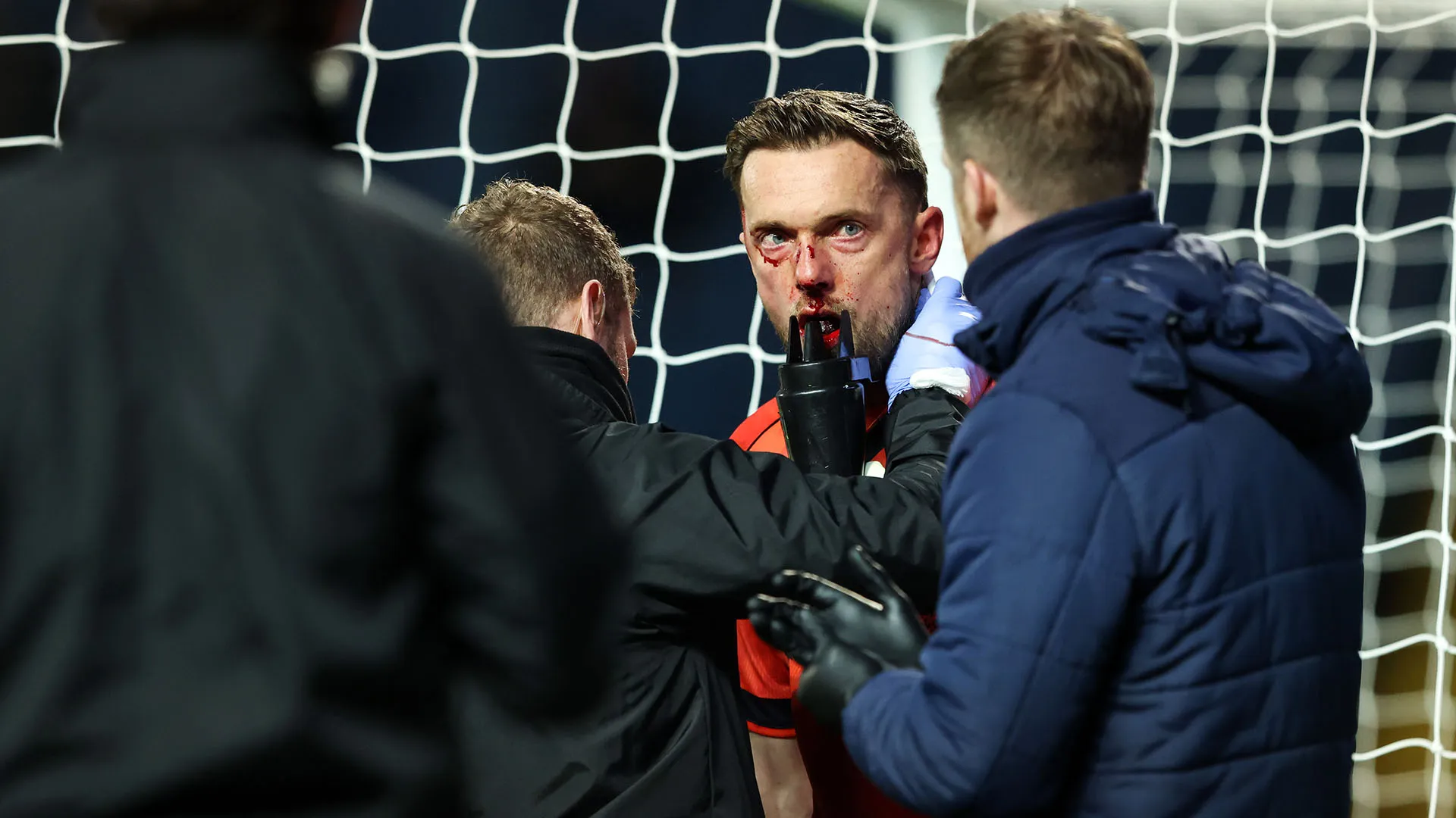 Ben Hamer perdeva sangue dalla bocca, dal naso e dallo zigomo: un disastro