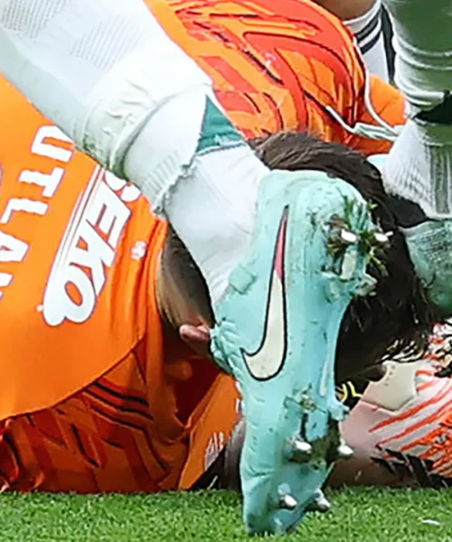 Violenta scarpata in testa, attimi di paura per il portiere. Le foto