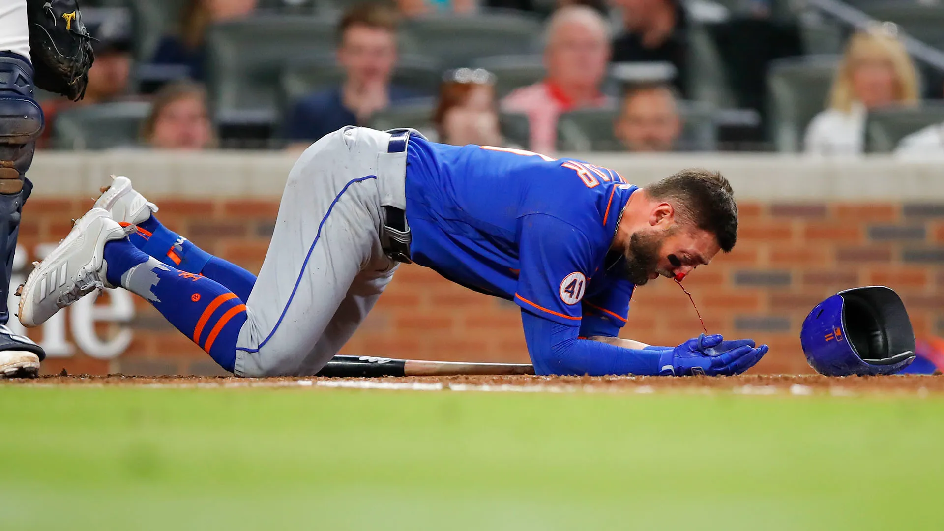 Pallina sul naso a oltre 150 km/h: le foto
