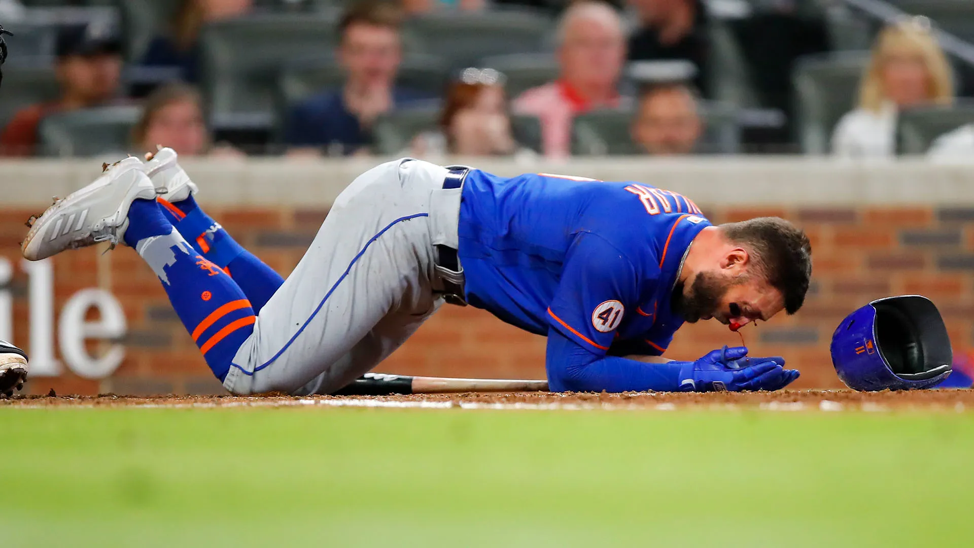 Nel 2021, durante New York Mets-Atlanta Braves, il campione venne colpito in faccia
