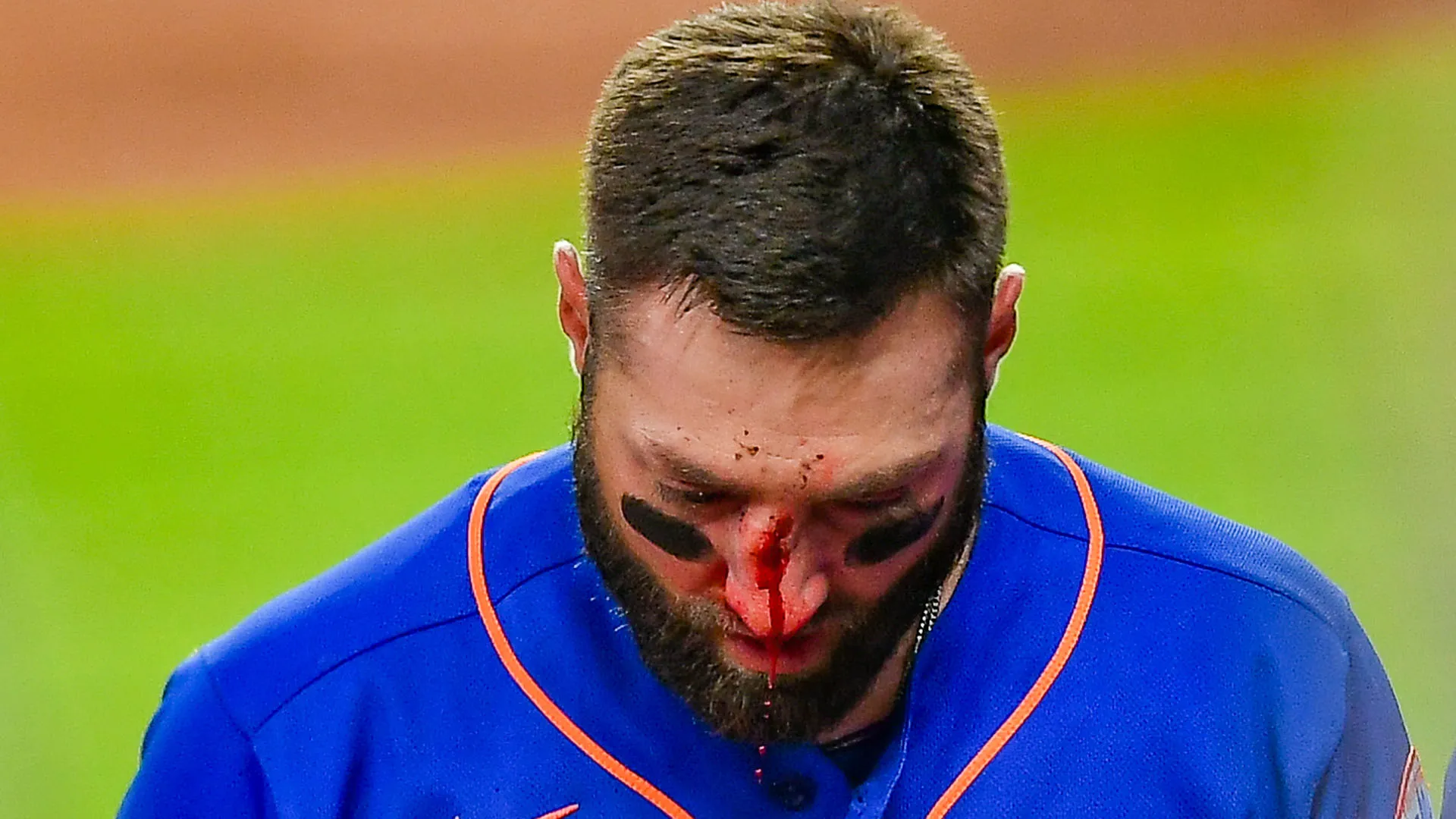 Evidentemente la tremenda botta gli aveva causato anche qualche problema agli occhi