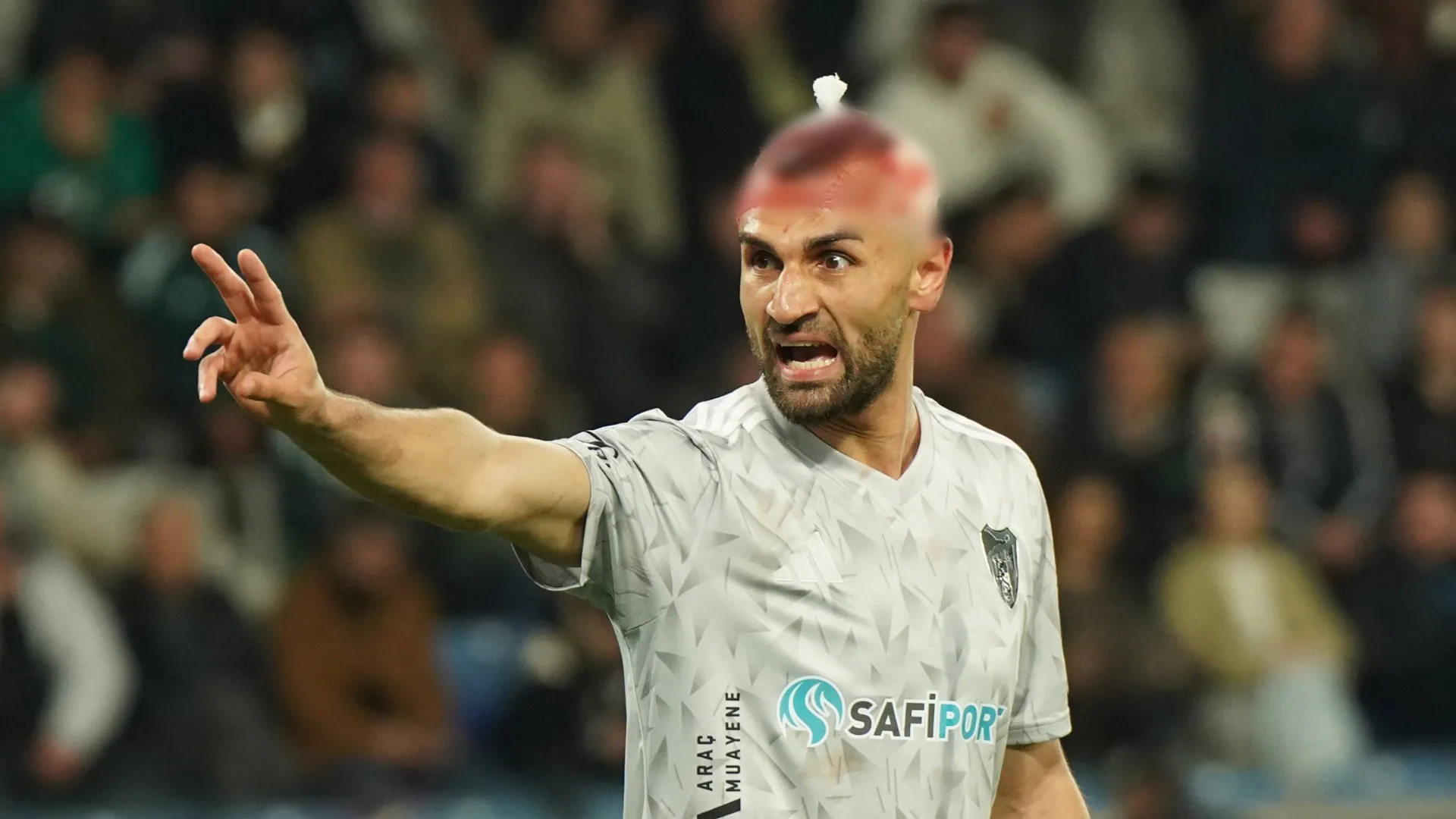 Evidentissima la ferita sulla testa di Serdar Dursun